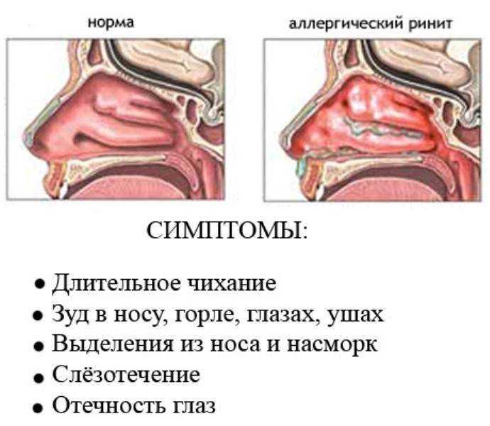 Слёзы, сопли и вопли — три стадии внедрения инфостиля в компании